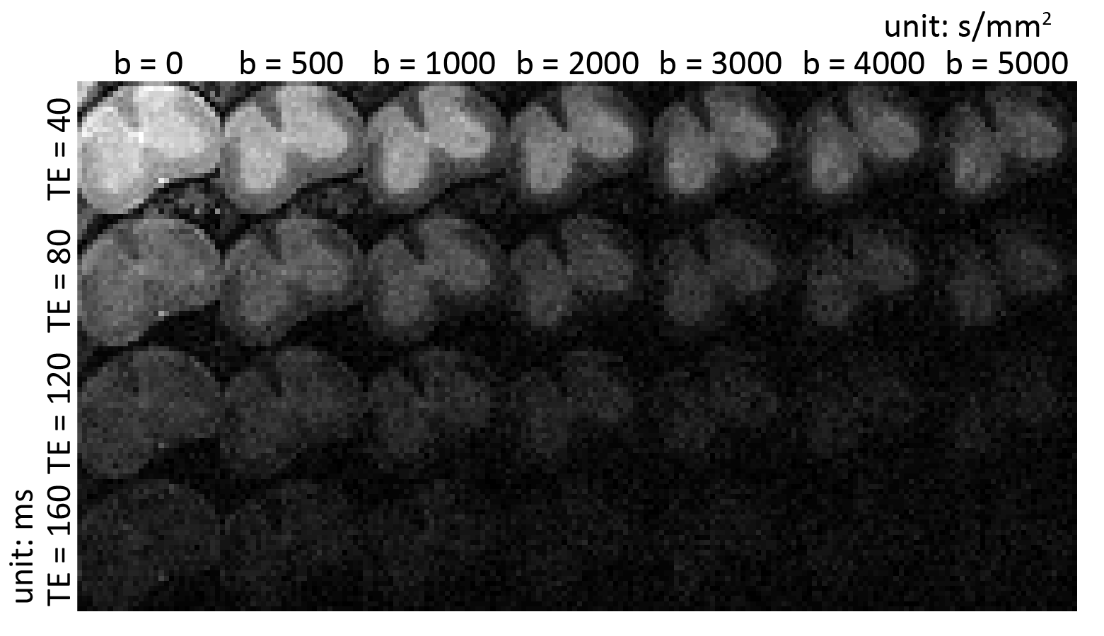 ../_images/ISMRM2017-005126_Fig1a.png